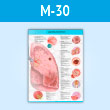 Плакат «Заболевания легких» (М-30, пластик 2 мм, A2, 1 лист)